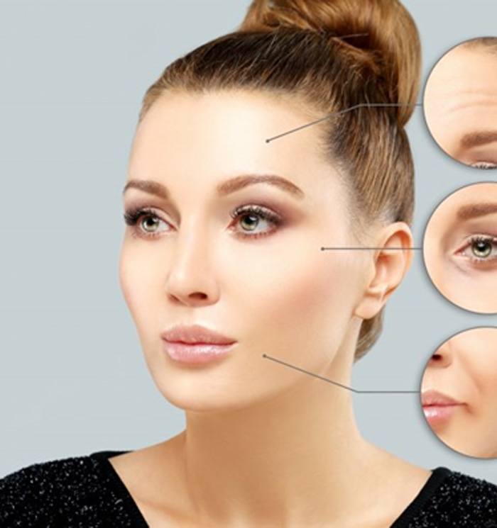 a woman with BOTOX before and after shots