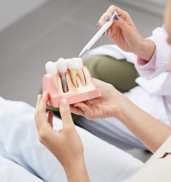 Dentist showing a patient a model of dental implants