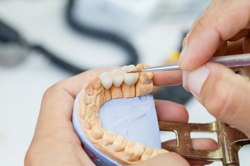 A dentist putting the finishing touches on some dental crowns