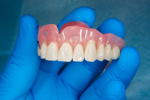 Gloved hand holding full dentures for upper arch